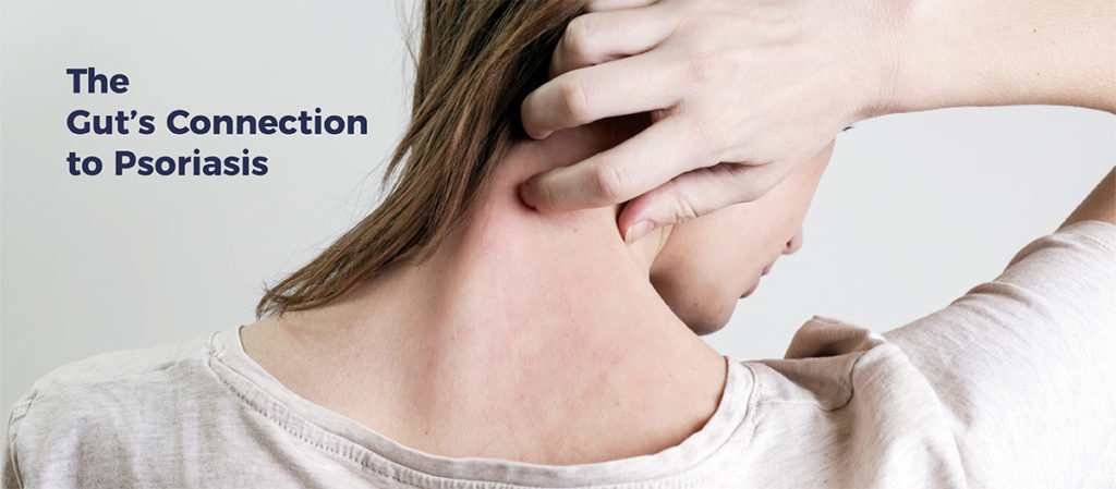 Women scratching irritated neck. TEXT: The Gut's Connection To Psoriasis