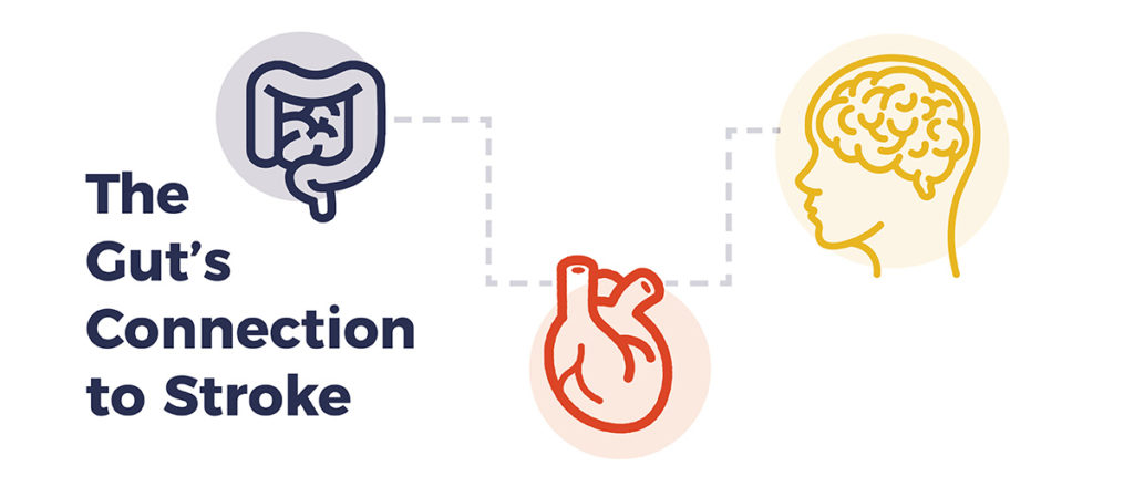 Illustration of a gut, a heart, and a brain all connected by a dotted line. Text: The Gut's connection to stroke