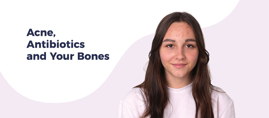 Headshot of young women with acne smiling and looking at camera. Text reads "Acne, Antibiotics and Your Bones"
